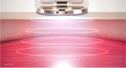 Massage cổ Mytrex Dr. Heat Neck